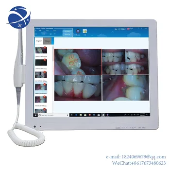 2021 vânzare fierbinte medicale, camera Intraorala flexibil orală endoscop imagine clară cu display de 17 inch, sistemul de OPERARE windows PC cu touch screen